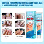 Crema Antifúngica para Uñas | Elimina Hongos, Engrosa y Restaura con Fórmula Herbal