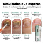 Pluma de Cuidado de Uñas | Trata Hongos, Repara y Fortalece con Fórmula Médica
