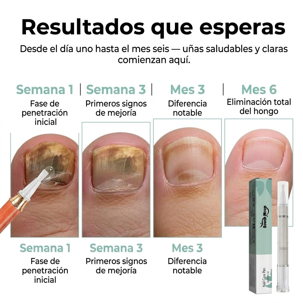 Pluma de Cuidado de Uñas | Trata Hongos, Repara y Fortalece con Fórmula Médica